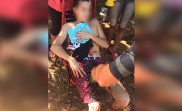 Menor es apuñalado por otra adolescente en Asentamiento Belén
