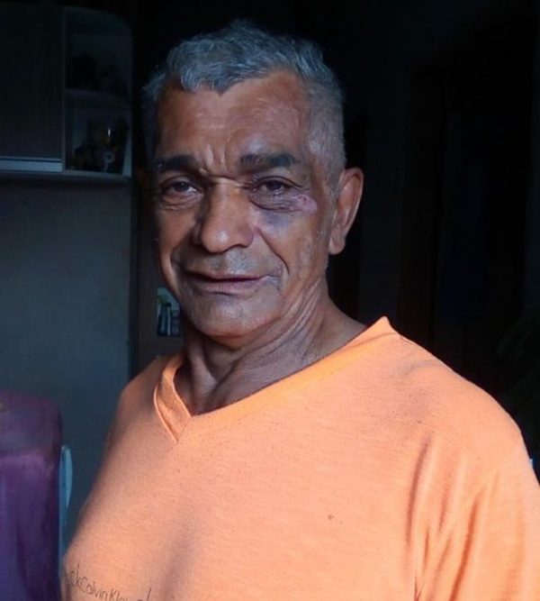 Persona desaparecida: Buscan a hombre con trastornos mentales