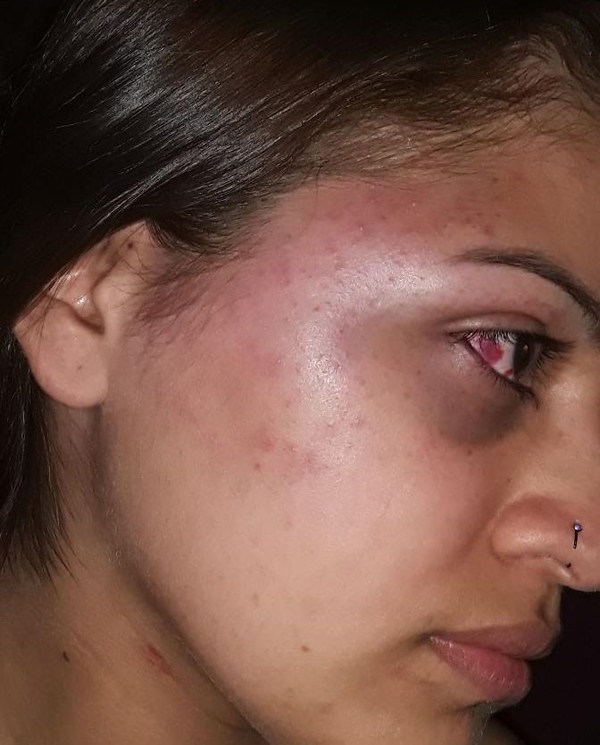 Fiscalía niega inacción en caso de violencia familiar - ADN Paraguayo