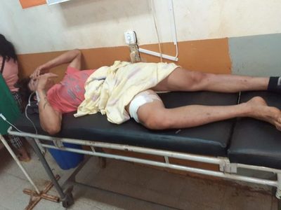 Policía hiere a un violento hombre en Hernandarias