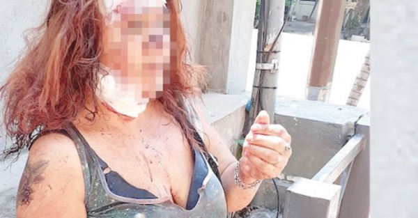 “Dios me protegió y él no me pudo matar”
