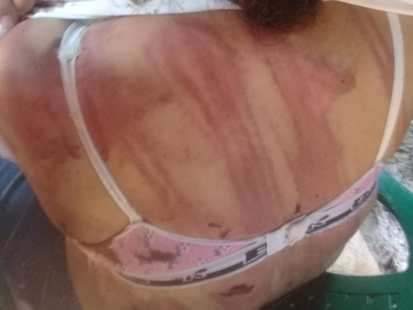 Brutalidad evidencia desamparo de las mujeres víctimas ante la Justicia