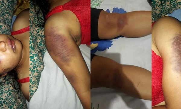 Raptó y golpeó brutalmente a su ex pareja