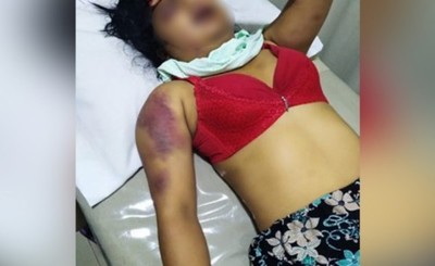 Raptó a su ex pareja, la golpeó salvajemente y la abandonó en Minga