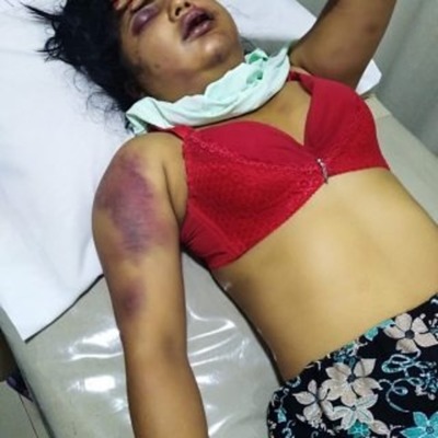 Raptan y golpean brutalmente a una joven