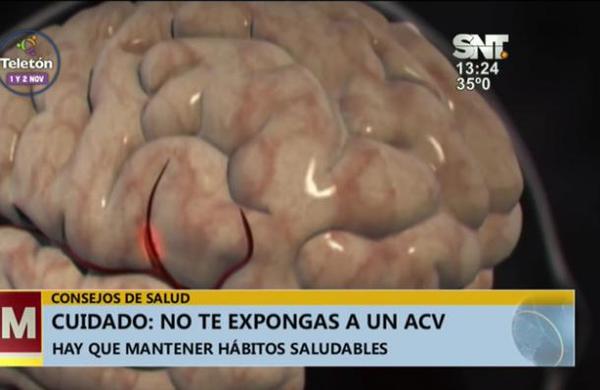 Consejos de Salud: No te expongas a un ACV - SNT