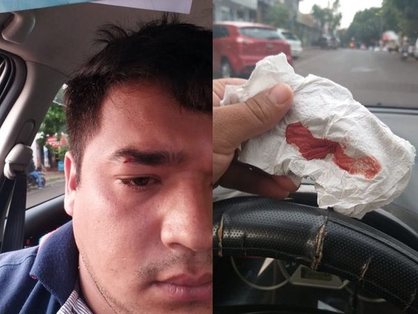 Limpia vidrios hiere a conductor frente a Seccional Colorada en CDE