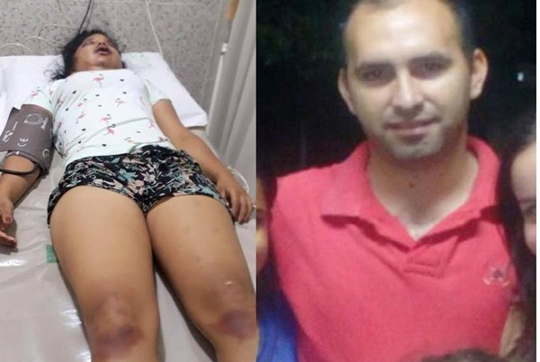 No logran detener al “torturador del Este”. Por poco no mató a golpes a su expareja - ADN Paraguayo