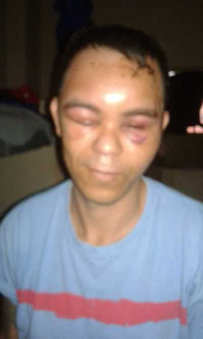 Denuncian que recluso fue golpeado y no asistido