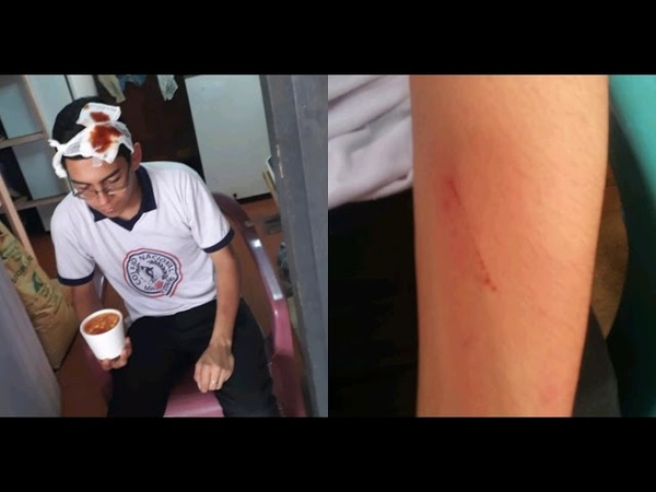MAYOR OTAÑO: ESTUDIANTE DENUNCIÓ SER AGREDIDO POR UN POLICIA
