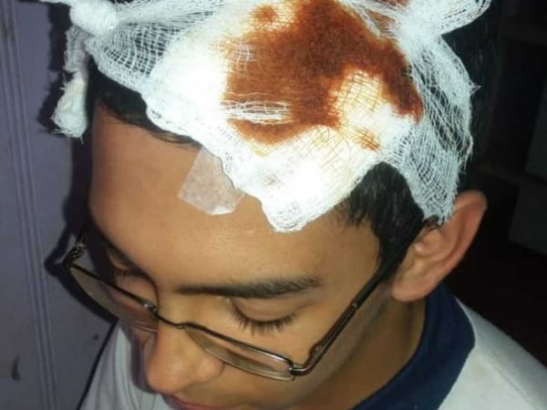 Le rompieron la cabeza a dirigente estudiantil de Mayor Otaño