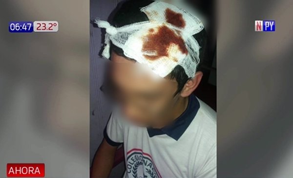 Policía rompe la cabeza a un estudiante | Noticias Paraguay