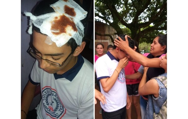 Mayor Otaño: Policía le rompió la cabeza a un estudiante que se manifestaba contra el intendente - ADN Paraguayo
