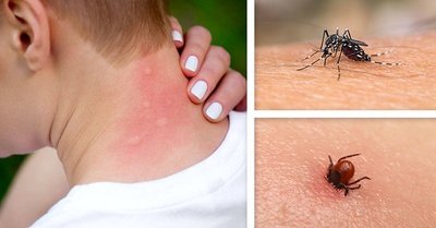 Recomendaciones para alérgicos ante picaduras de insectos » Ñanduti