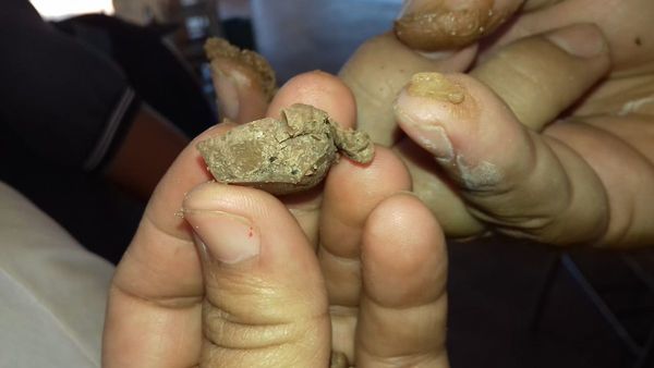 Encuentran pedazos de vidrios en chocolate en escuela de San Pedro