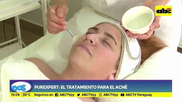 Purexperet: el tratamiento para el acné - Ensiestados - ABC Color
