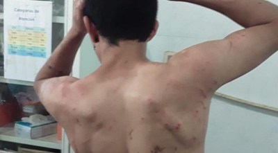 ABEJAS OBLIGAN A ENTREGARSE A UN LADRÓN QUE HUÍA DE LOS LINCES