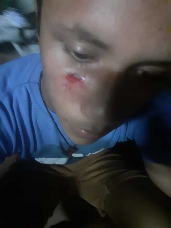 Arroyito: Jóvenes manifestantes fueron atacados por seguidores de Intendente