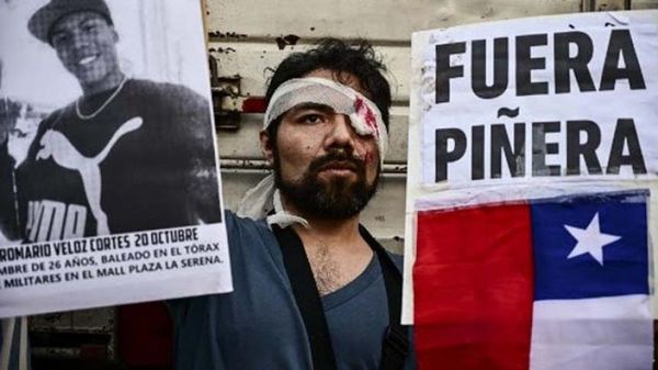 Las lesiones oculares y la ceguera, marcas indelebles de protestas