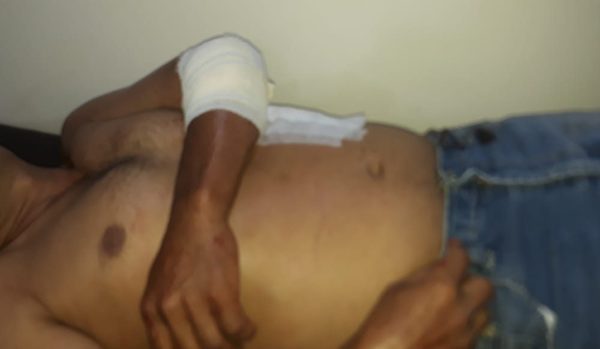 Por defender a su padre hirió a su hermano