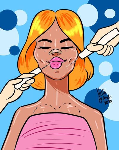 Cirugía plástica: cuando el deseo de belleza puede mejorar o dañar tu cuerpo - Periodismo Joven - ABC Color