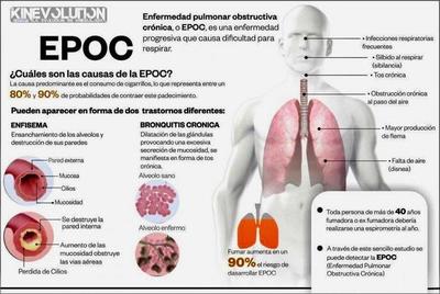 Médicos del Hospital Regional de CDE realizarán pruebas por medio de la espirometría