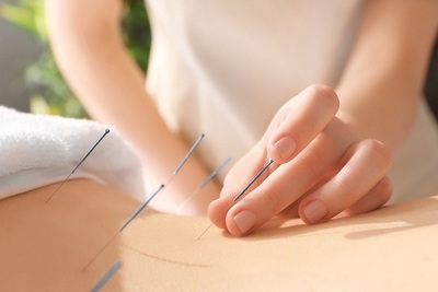 Acupuntura en la salud pública: 10 datos para saber de qué se trata