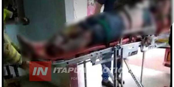 NATALIO: A JOVEN ACCIDENTADO LE AMPUTARON UNA PIERNA Y TIENE QUEMADURAS EN UN 80%