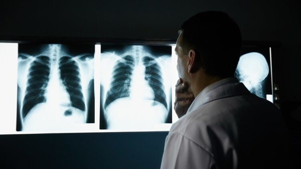 Realizarán evaluaciones y espirometrías gratuitas en el Hospital de Clínicas » Ñanduti