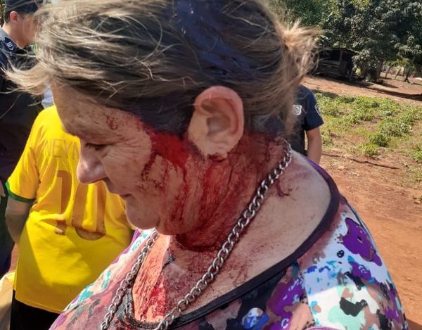 Ebrio golpeó brutalmente a su hermana