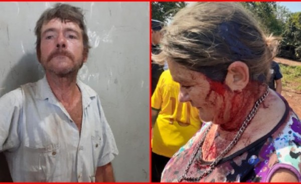 Golpeó en la cabeza a su hermana con un palo de madera