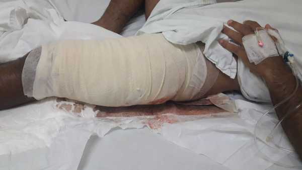 A patadas, un instructor policial destrozó tendones de un suboficial concepcionero