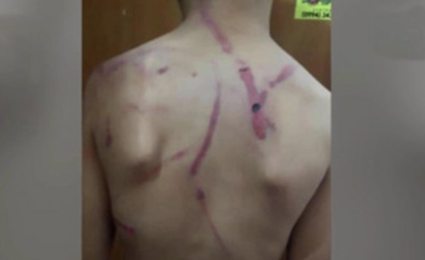 Brutal agresión a niño de 10 años.