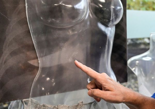 Cruda exposición para denunciar la violencia