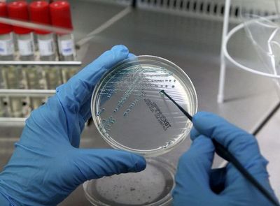 Modifican bacteria para que “coma” dióxido de carbono - Internacionales - ABC Color