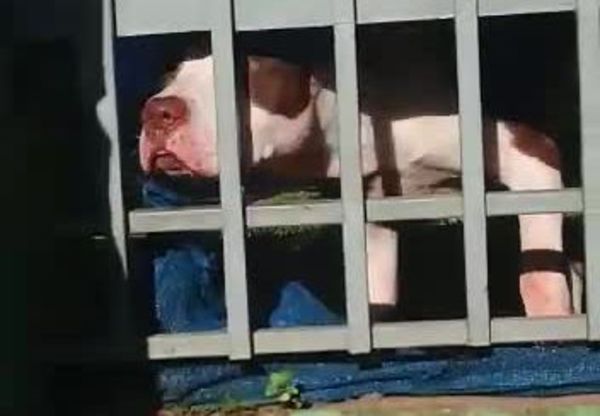 Mujer de 90 años brutalmente mordida por el pitbull de su hija - Nacionales - ABC Color