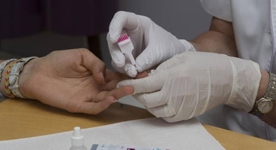 HOY / VIH: Estigma y discriminación traban diagnóstico y tratamiento oportunos