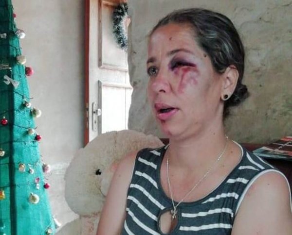 Concepción: Mujer fue derribada de su moto por desconocidos