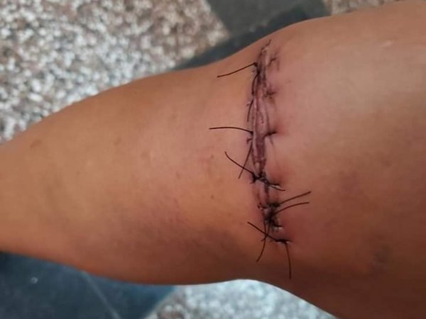 Su ex la golpeó brutalmente porque se negó a tener relaciones