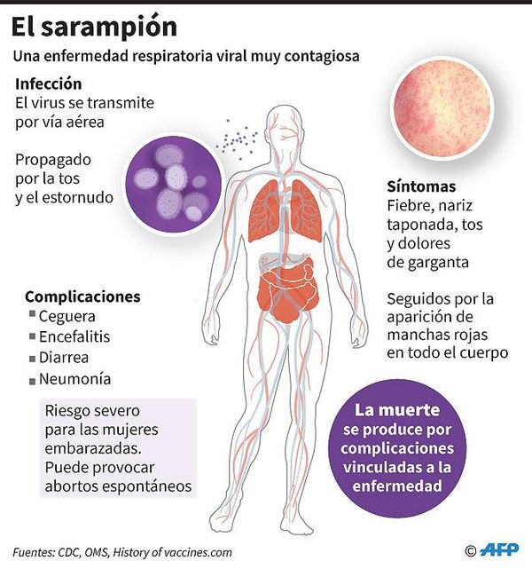 El sarampión acecha por “fracaso” en vacunación - Internacionales - ABC Color