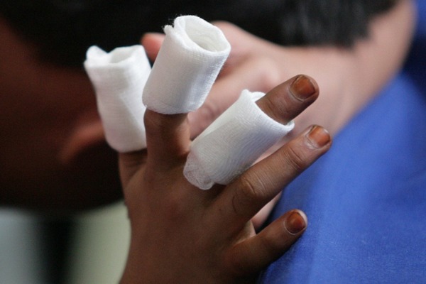 Bebé pierde parte de sus dedos tras la explosión de un petardo
