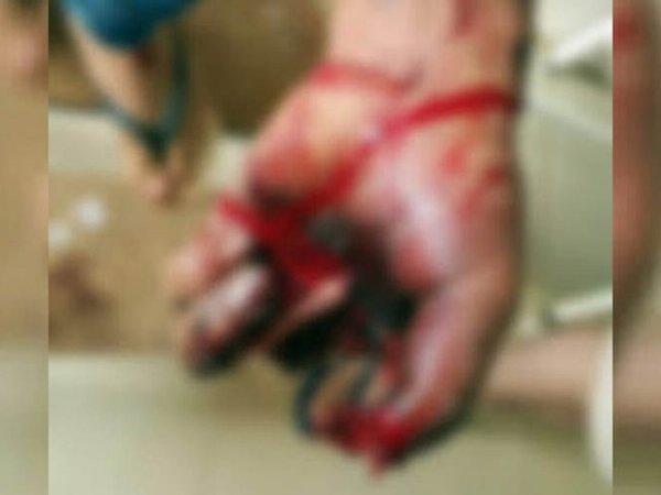 Un cebollón explotó por la mano de un nene de 2 añitos