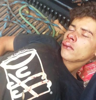 Ebrio fue golpeado tras generar disturbios en CDE