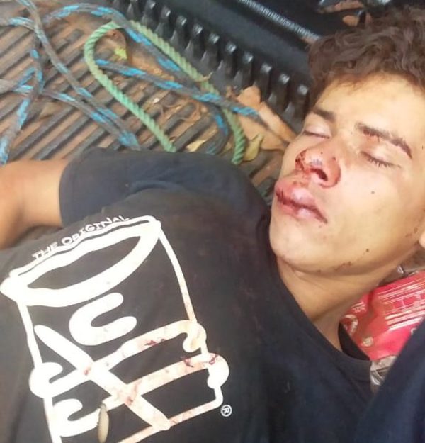Ebrio fue golpeado tras generar disturbios en CDE