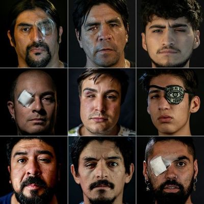 “Me cambió la vida”: relatos de heridos oculares en la revuelta en Chile