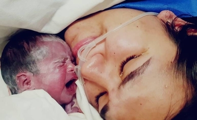 HOY / Nace la beba que fue intervenida en la cirugía intrautero