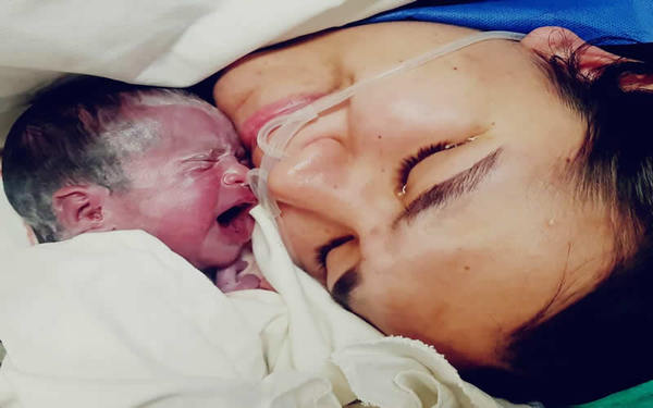 Nace la beba que se sometió a la primera cirugía intrautero