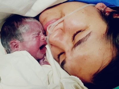 Nació Iris, la pequeña que fue sometida a la primera intervención quirúrgica intrautero