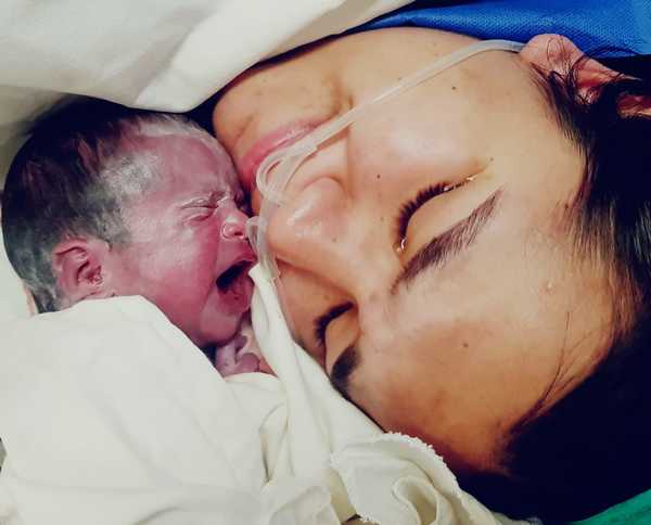 Nació Iris, la beba que tuvo la primera cirugía intrauterina