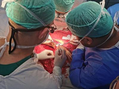Realizan primer implante total de mano tras amputación traumática en IPS - ADN Paraguayo
